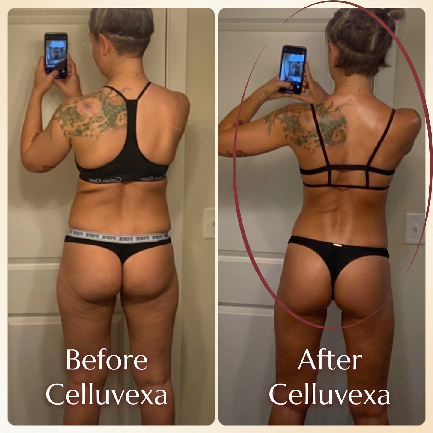 Celluvexa SculptRoll™