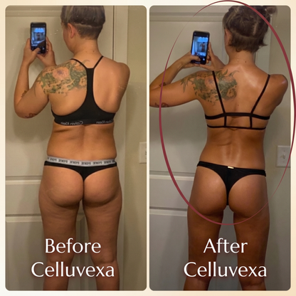 Celluvexa SculptRoll™